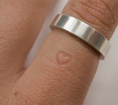 Обручальное кольцо. Если вы долго будете носить его, то на вашем пальце останется след от маленького сердечка.